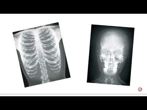 True To Life Human X-Rays - Image 3